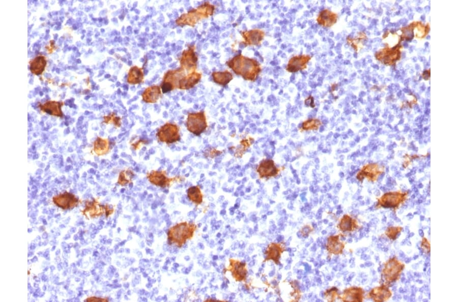 Immunohistochemistry - Anti-CD30 Antibody - BSA and Azide free (A253836) - Antibodies.com