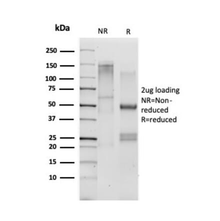 SDS-PAGE - Anti-CD33 Antibody [SIGLEC3/3600] - BSA and Azide free (A253838) - Antibodies.com