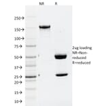 SDS-PAGE - Anti-ATG5 Antibody [ATG5/2101] - BSA and Azide free (A253840) - Antibodies.com
