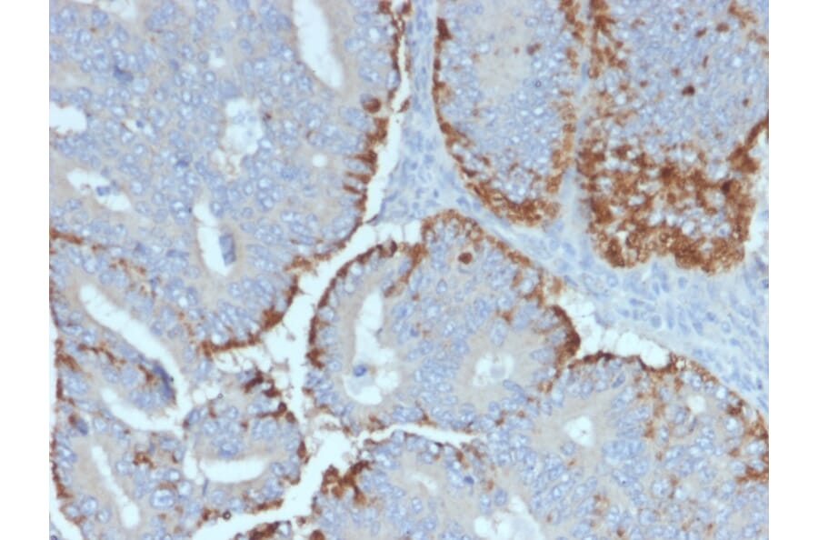 Immunohistochemistry - Anti-ATG5 Antibody [ATG5/2492] - BSA and Azide free (A253841) - Antibodies.com