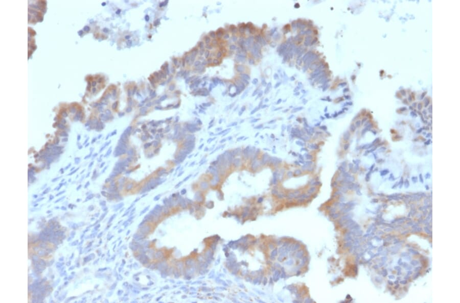 Immunohistochemistry - Anti-ATG5 Antibody [ATG5/2492] - BSA and Azide free (A253841) - Antibodies.com