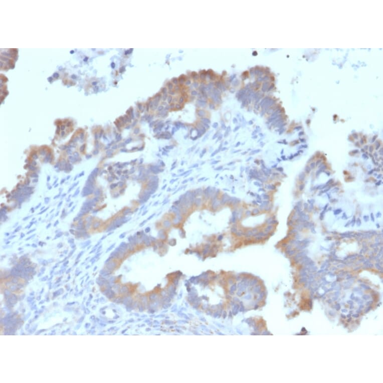 Immunohistochemistry - Anti-ATG5 Antibody [ATG5/2492] - BSA and Azide free (A253841) - Antibodies.com