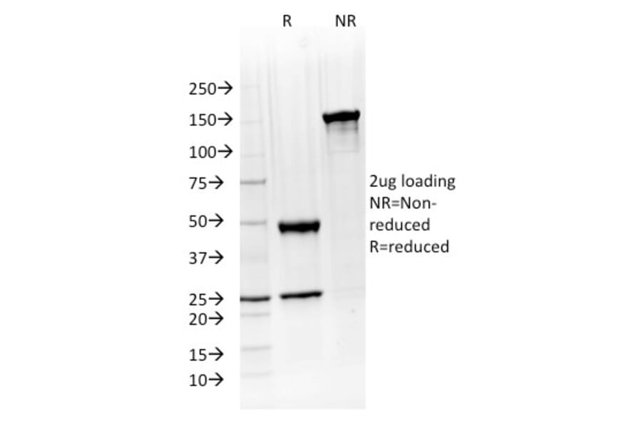 SDS-PAGE - Anti-ATG5 Antibody [ATG5/2492] - BSA and Azide free (A253841) - Antibodies.com