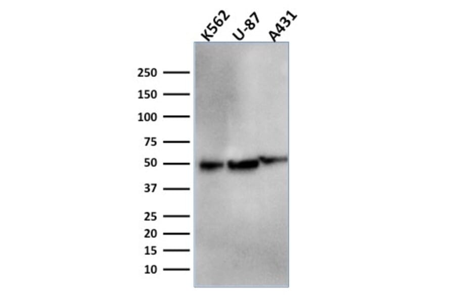 Western Blot - Anti-ATG5 Antibody [ATG5/2553] - BSA and Azide free (A253842) - Antibodies.com