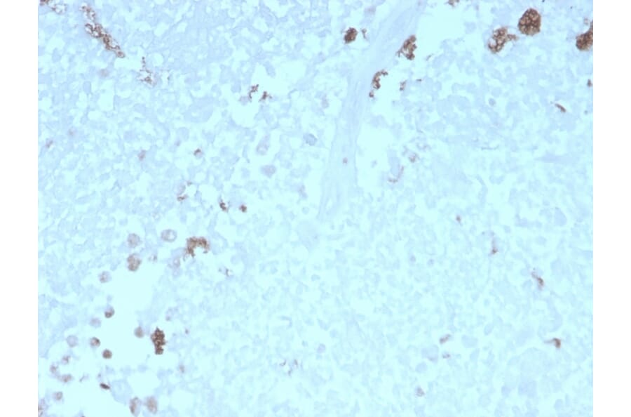 Immunohistochemistry - Anti-ATG5 Antibody [rATG5/2553] - BSA and Azide free (A253843) - Antibodies.com