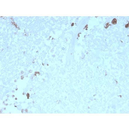 Immunohistochemistry - Anti-ATG5 Antibody [rATG5/2553] - BSA and Azide free (A253843) - Antibodies.com