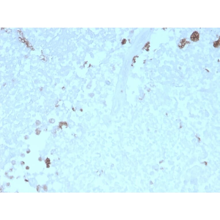 Immunohistochemistry - Anti-ATG5 Antibody [rATG5/2553] - BSA and Azide free (A253843) - Antibodies.com