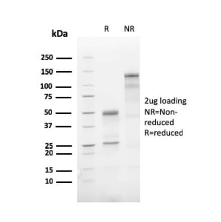 SDS-PAGE - Anti-ATG5 Antibody [AGT5/3220R] - BSA and Azide free (A253843) - Antibodies.com
