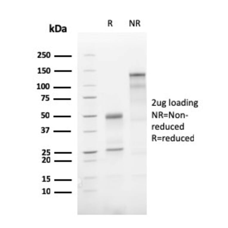 SDS-PAGE - Anti-ATG5 Antibody [AGT5/3220R] - BSA and Azide free (A253843) - Antibodies.com