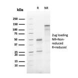 SDS-PAGE - Anti-ATG5 Antibody [AGT5/3220R] - BSA and Azide free (A253843) - Antibodies.com