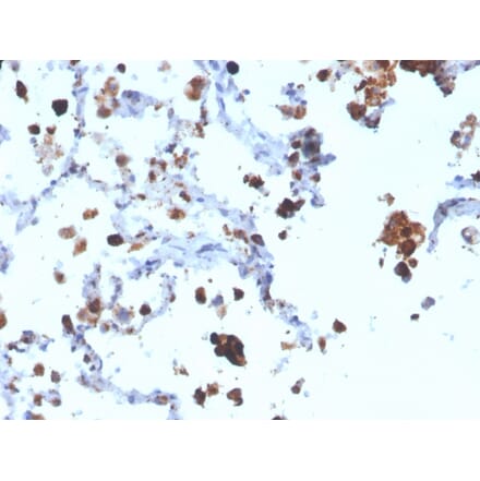Immunohistochemistry - Anti-NAPSIN A Antibody [NAPSA/3308] - BSA and Azide free (A253845) - Antibodies.com