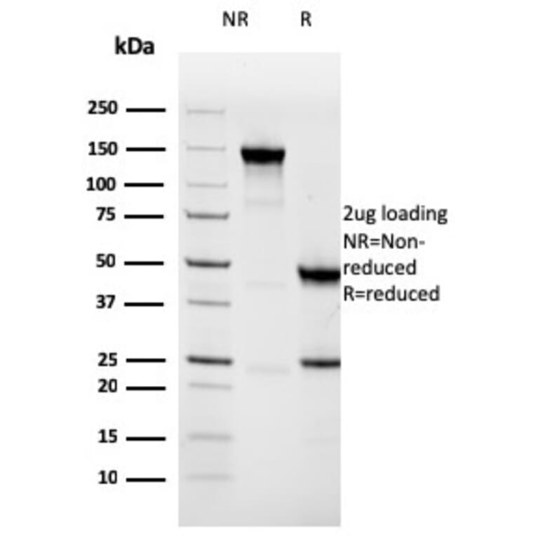 SDS-PAGE - Anti-NAPSIN A Antibody [NAPSA/3308] - BSA and Azide free (A253845) - Antibodies.com