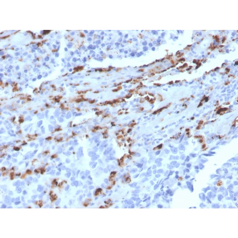 Immunohistochemistry - Anti-NAPSIN A Antibody [NAPSA/3309] - BSA and Azide free (A253846) - Antibodies.com