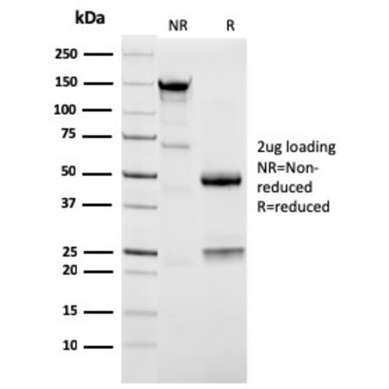 SDS-PAGE - Anti-NAPSIN A Antibody [NAPSA/3309] - BSA and Azide free (A253846) - Antibodies.com