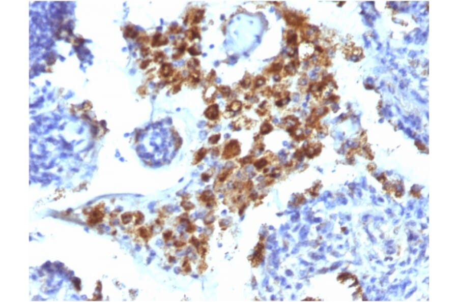 Immunohistochemistry - Anti-NAPSIN A Antibody [NAPSA/1238] - BSA and Azide free (A253847) - Antibodies.com