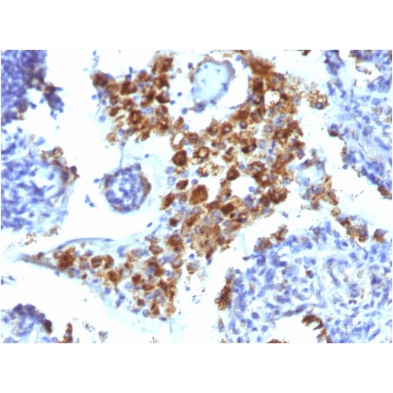 Immunohistochemistry - Anti-NAPSIN A Antibody [NAPSA/1238] - BSA and Azide free (A253847) - Antibodies.com