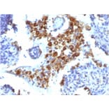 Immunohistochemistry - Anti-NAPSIN A Antibody [NAPSA/1238] - BSA and Azide free (A253847) - Antibodies.com