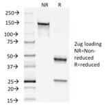SDS-PAGE - Anti-NAPSIN A Antibody [NAPSA/1238] - BSA and Azide free (A253847) - Antibodies.com