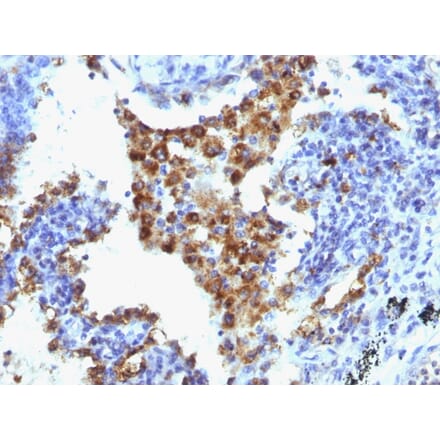 Immunohistochemistry - Anti-NAPSIN A Antibody [NAPSA/1238 + NAPSA/1239] - BSA and Azide free (A253848) - Antibodies.com