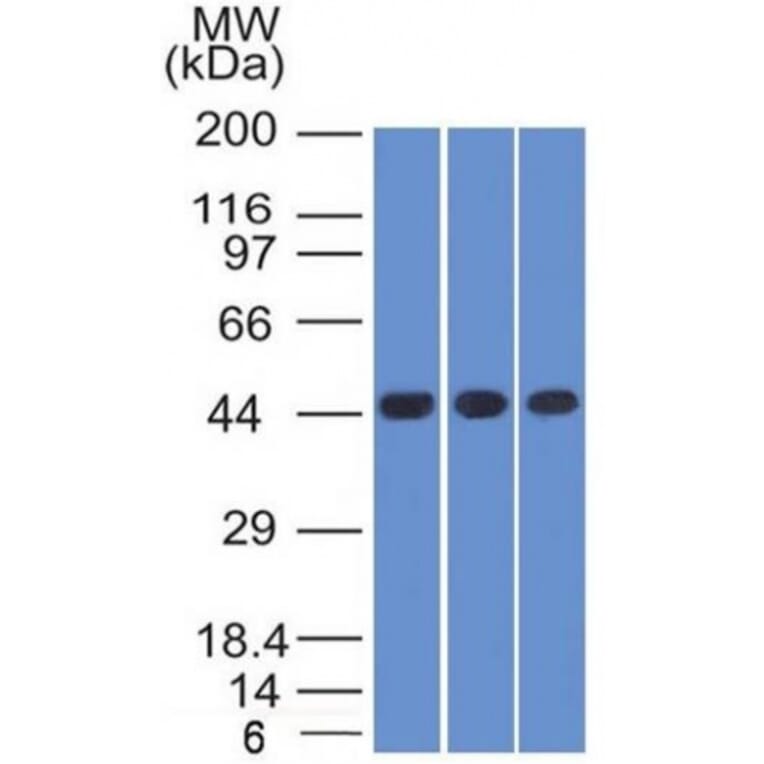 Western Blot - Anti-NAPSIN A Antibody [NAPSA/1238 + NAPSA/1239] - BSA and Azide free (A253849) - Antibodies.com