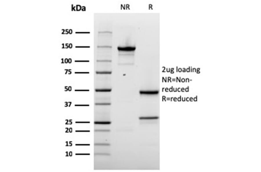 SDS-PAGE - Anti-NAPSIN A Antibody [rNAPSA/1239] - BSA and Azide free (A253850) - Antibodies.com