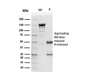 SDS-PAGE - Anti-NAPSIN A Antibody [NAPSA/3305] - BSA and Azide free (A253851) - Antibodies.com