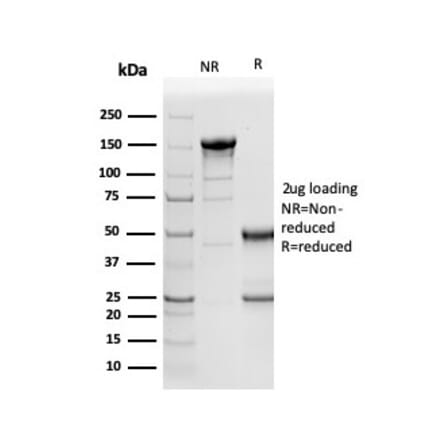 SDS-PAGE - Anti-NAPSIN A Antibody [NAPSA/3305] - BSA and Azide free (A253851) - Antibodies.com