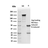 SDS-PAGE - Anti-NAPSIN A Antibody [NAPSA/3305] - BSA and Azide free (A253851) - Antibodies.com