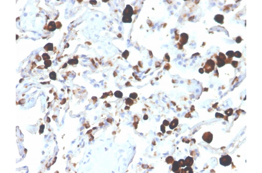 Immunohistochemistry - Anti-NAPSIN A Antibody [NAPSA/3305] - BSA and Azide free (A253851) - Antibodies.com