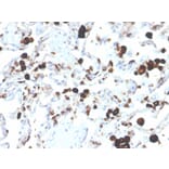 Immunohistochemistry - Anti-NAPSIN A Antibody [NAPSA/3305] - BSA and Azide free (A253851) - Antibodies.com