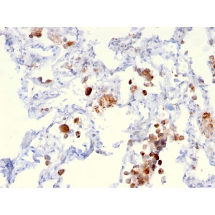 Immunohistochemistry - Anti-NAPSIN A Antibody [NAPSA/3306] - BSA and Azide free (A253852) - Antibodies.com