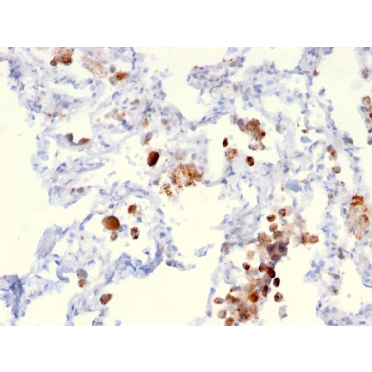 Immunohistochemistry - Anti-NAPSIN A Antibody [NAPSA/3306] - BSA and Azide free (A253852) - Antibodies.com