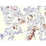 Immunohistochemistry - Anti-NAPSIN A Antibody [NAPSA/3306] - BSA and Azide free (A253852) - Antibodies.com