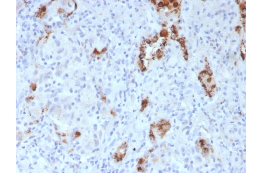 Immunohistochemistry - Anti-NAPSIN A Antibody [NAPSA/3307] - BSA and Azide free (A253853) - Antibodies.com