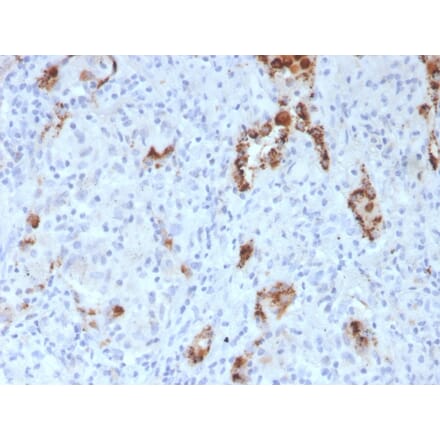 Immunohistochemistry - Anti-NAPSIN A Antibody [NAPSA/3307] - BSA and Azide free (A253853) - Antibodies.com