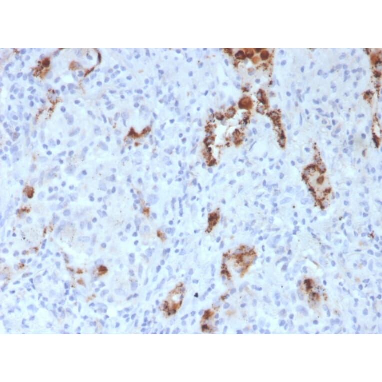 Immunohistochemistry - Anti-NAPSIN A Antibody [NAPSA/3307] - BSA and Azide free (A253853) - Antibodies.com