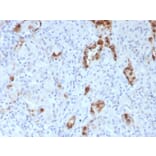Immunohistochemistry - Anti-NAPSIN A Antibody [NAPSA/3307] - BSA and Azide free (A253853) - Antibodies.com
