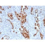 Immunohistochemistry - Anti-NAPSIN A Antibody [NAPSA/3307] - BSA and Azide free (A253853) - Antibodies.com