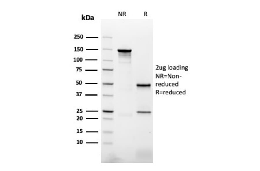 SDS-PAGE - Anti-NAPSIN A Antibody [NAPSA/3307] - BSA and Azide free (A253853) - Antibodies.com