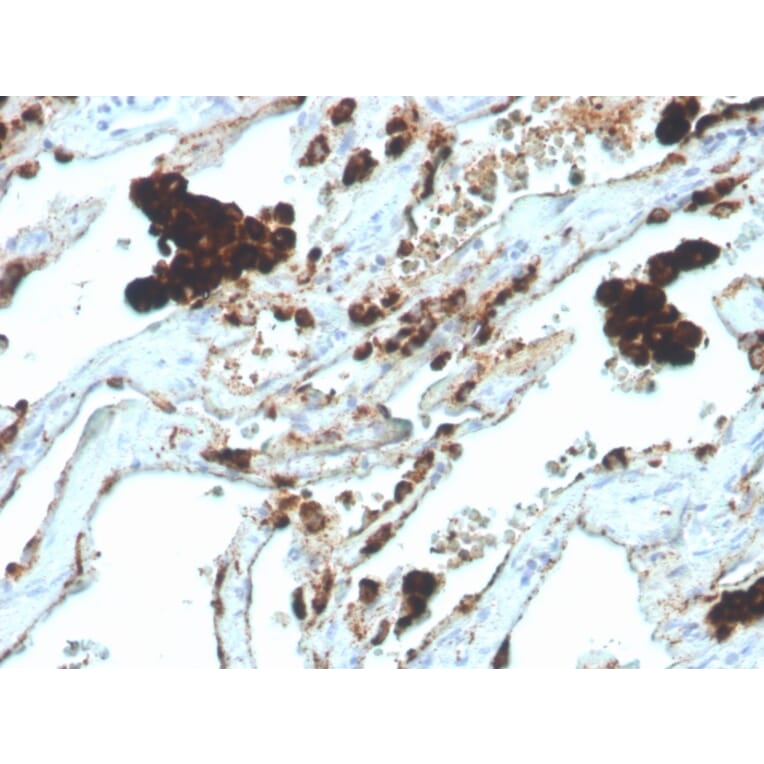 Immunohistochemistry - Anti-NAPSIN A Antibody [NAPSA/4400R] - BSA and Azide free (A253854) - Antibodies.com