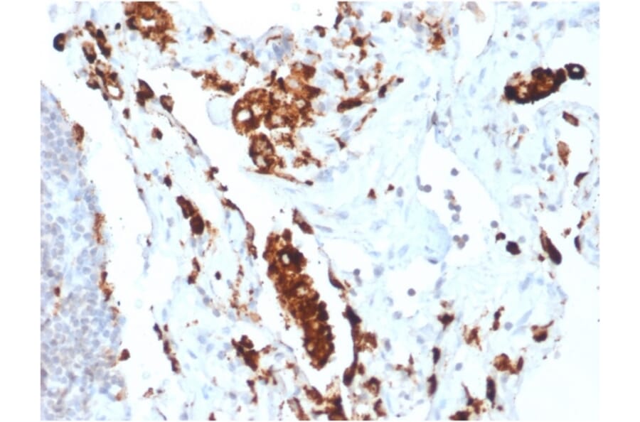 Immunohistochemistry - Anti-NAPSIN A Antibody [NAPSA/1865R] - BSA and Azide free (A253854) - Antibodies.com