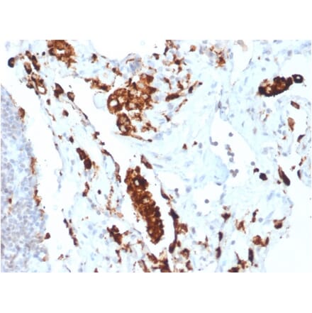 Immunohistochemistry - Anti-NAPSIN A Antibody [NAPSA/1865R] - BSA and Azide free (A253854) - Antibodies.com