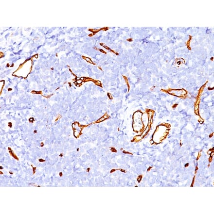 Immunohistochemistry - Anti-CD34 Antibody [SPM123] - BSA and Azide free (A253857) - Antibodies.com