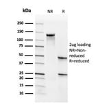 SDS-PAGE - Anti-CD34 Antibody [SPM610] - BSA and Azide free (A253862) - Antibodies.com