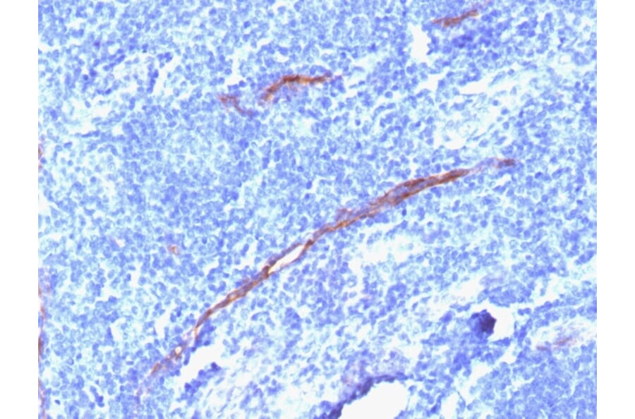 Immunohistochemistry - Anti-CD34 Antibody [HPCA1/1806R] - BSA and Azide free (A253863) - Antibodies.com
