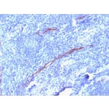 Immunohistochemistry - Anti-CD34 Antibody [HPCA1/1806R] - BSA and Azide free (A253863) - Antibodies.com