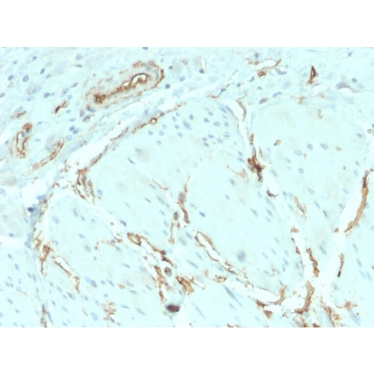 Immunohistochemistry - Anti-CD34 Antibody [HPCA1/2598R] - BSA and Azide free (A253864) - Antibodies.com