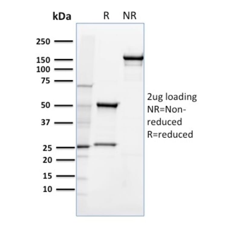 SDS-PAGE - Anti-CD36 Antibody [185-1G2] - BSA and Azide free (A253865) - Antibodies.com