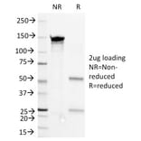 SDS-PAGE - Anti-CD36 Antibody [1E8] - BSA and Azide free (A253867) - Antibodies.com