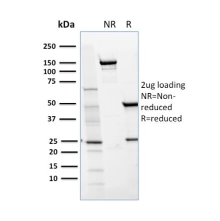 SDS-PAGE - Anti-CD36 Antibody [GPIIIb/1654] - BSA and Azide free (A253868) - Antibodies.com
